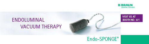 B Braun. Endoluminal Vacuum Therapy. Visit us at Booth no 57!