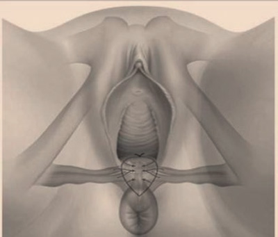 Illustration showing female perineum