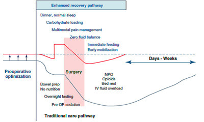 Chart showing surgical stress response and perioperative care